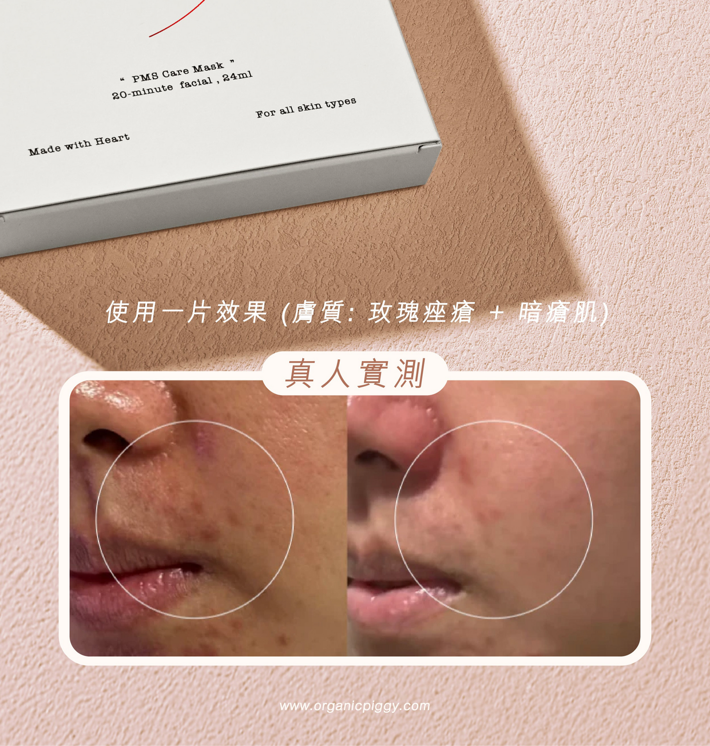 PMS急救降紅面膜