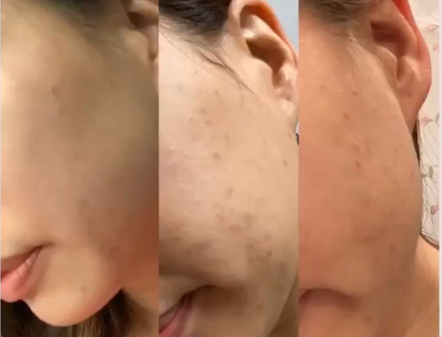 水果酵素煥膚面膜